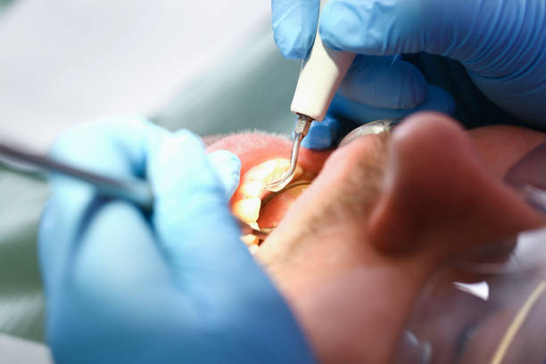Best Weekend Emergency Dentist in Williamsburg, FL