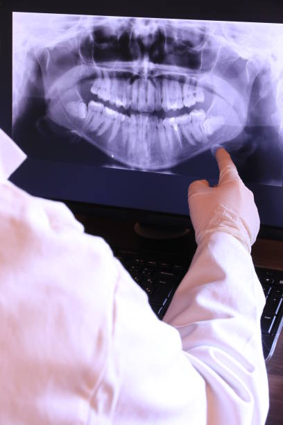 Best Emergency Tooth Extraction in Williamsburg, FL